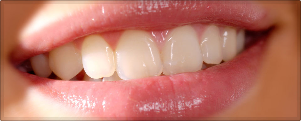 Cosmetic Dentistry India